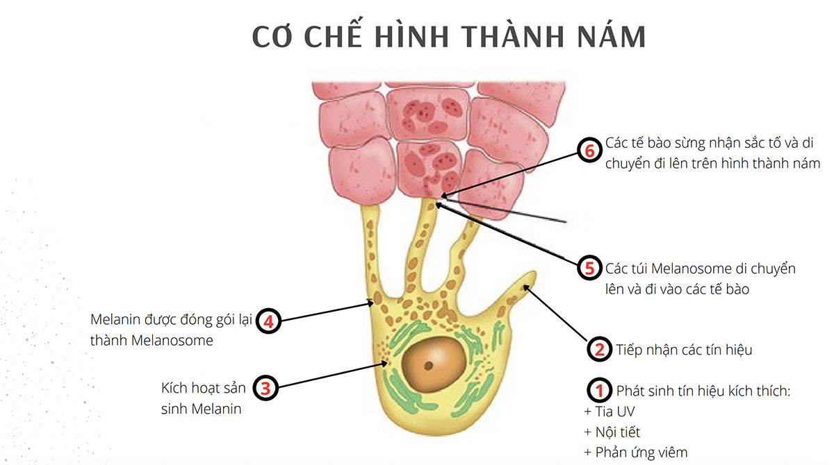 So Sánh Peel Da Và Laser Trị Nám: Phương Pháp Nào Hiệu Quả Hơn?