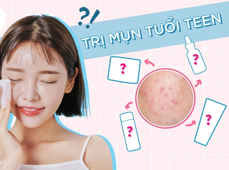 Cách trị mụn ở tuổi dậy thì nữ