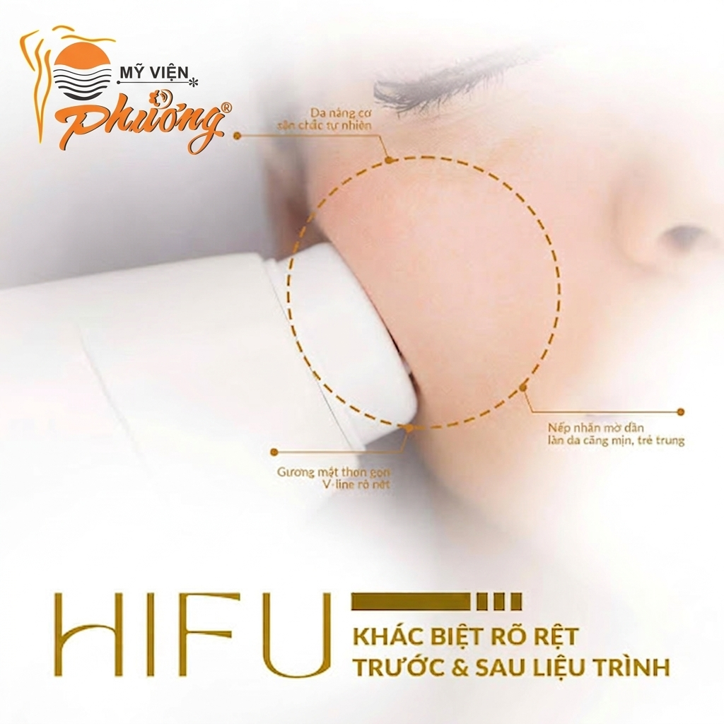 Chăm Sóc Da Sau HIFU: Quy Trình Chuẩn Giúp Da Căng Bóng, Khỏe Mạnh